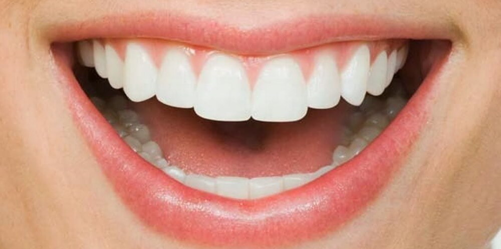 процедура реминерализации зубов человека